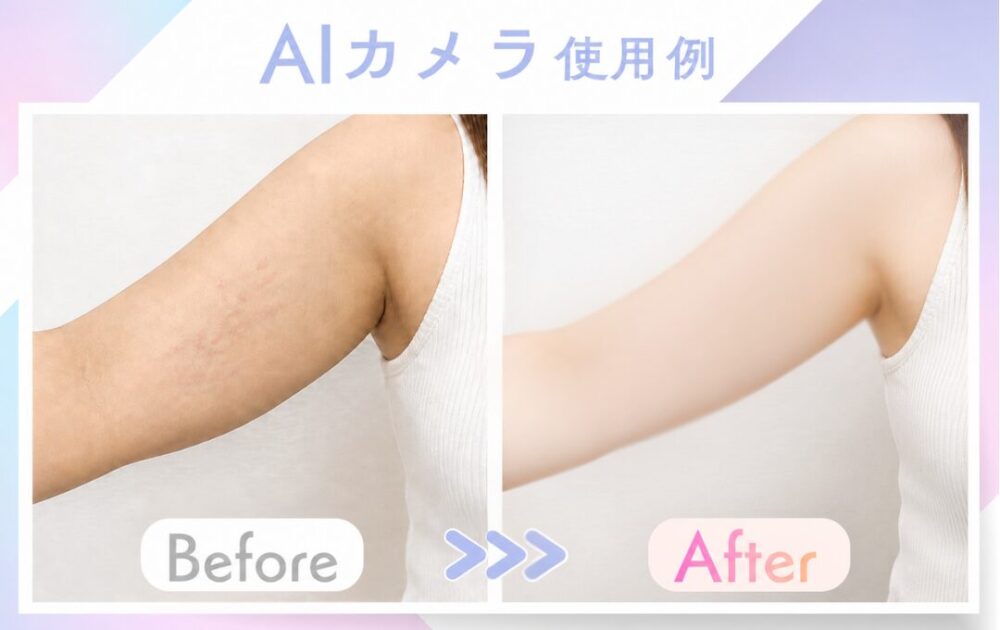 AIカメラのビフォーアフター身体